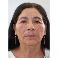 Graciela Mercedes Yoplac Portocarrero